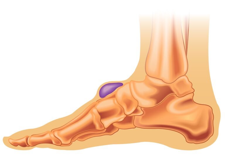 Soft tissue lumps and bumps