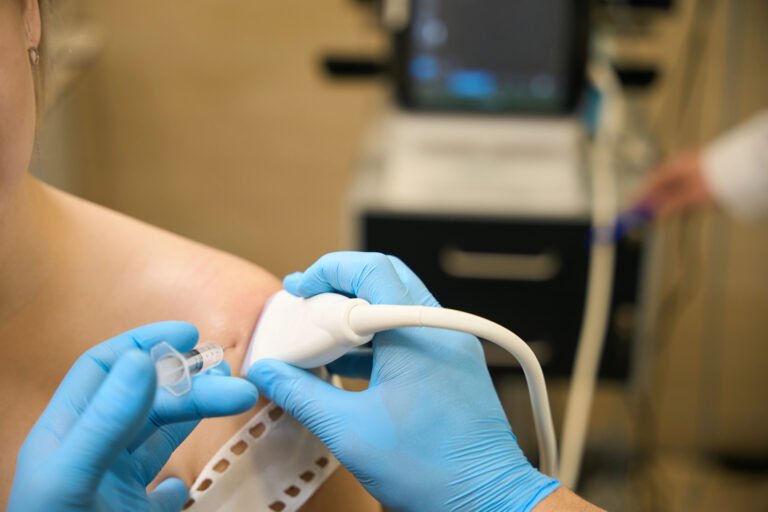 Ultrasound guided steroid injection